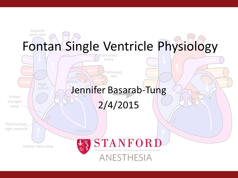 Fontan Single Ventricle Physiology
