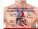 Pacemakers: Designation, DDD Management, and Electrocautery