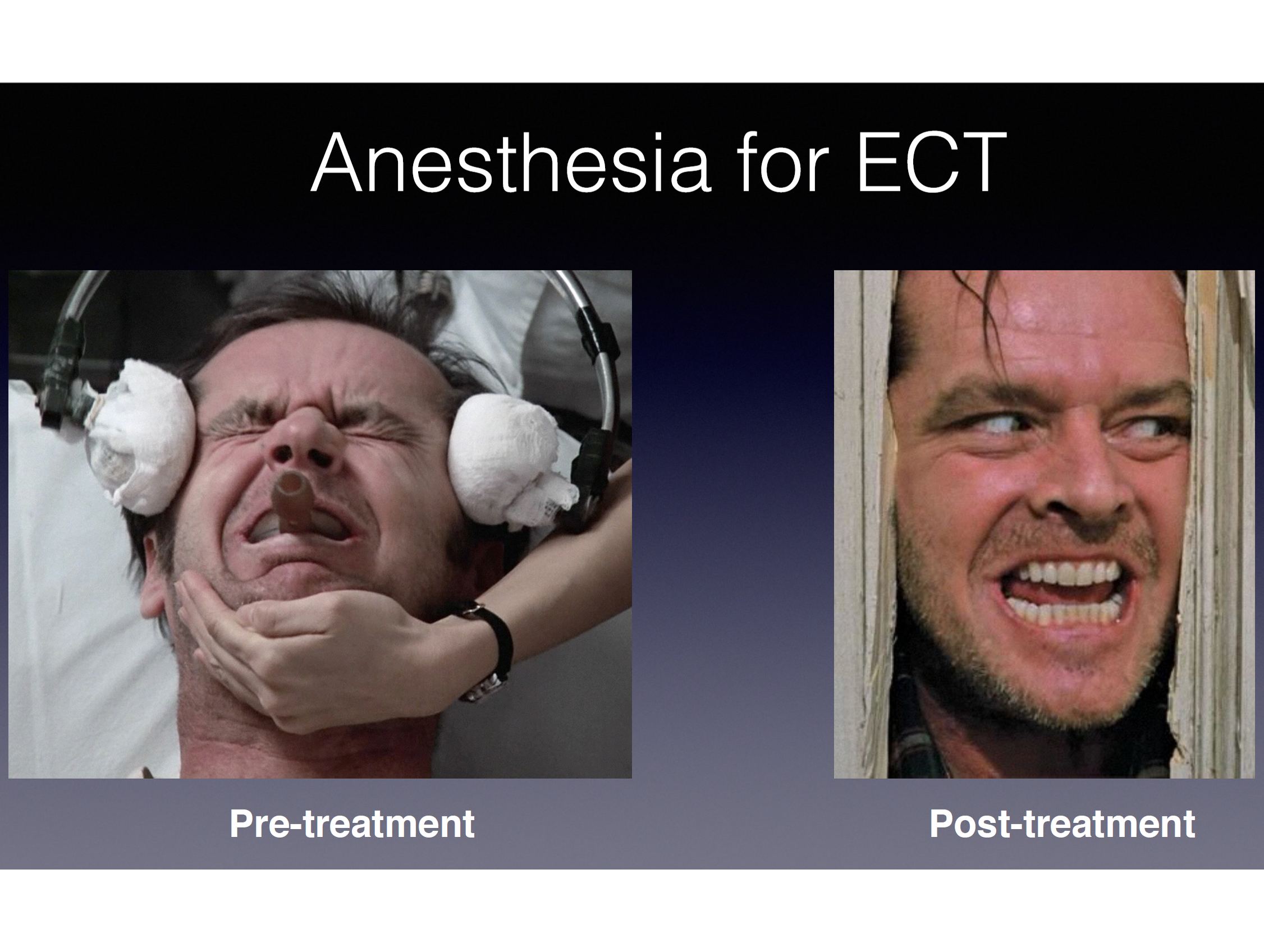 Anesthesia for ECT
