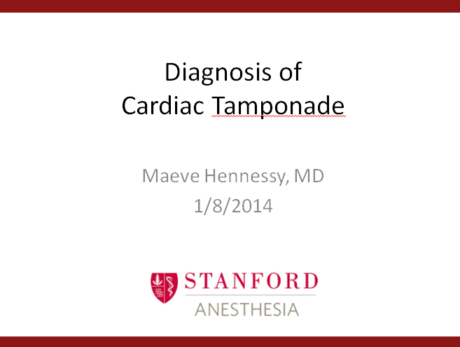 Diagnosis of Cardiac Tamponad