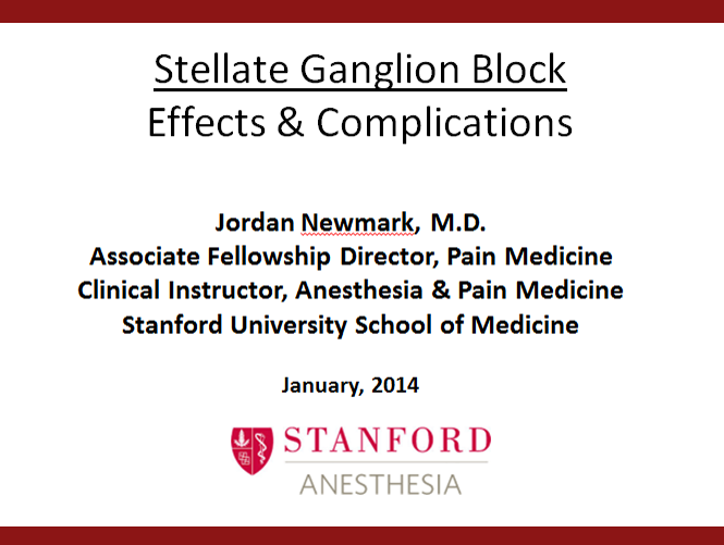 Stellate Ganglion Block: Effects & Complications