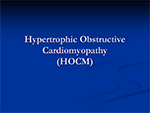 Hypertrophic Obstructive Cardiomyopathy (HOCM)