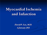 Current Management of Myocardial Ischemia and Infarction