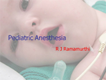 Pediatric General Anesthesia