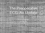 The-Perioperative-ECG---Update